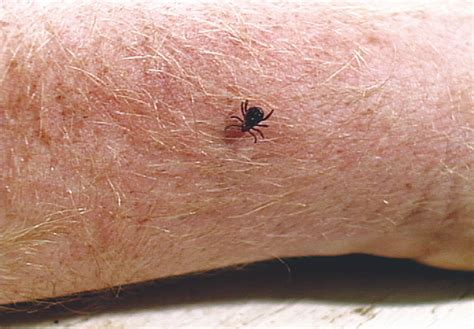 They have wings, are 3/16 inches long, have long snouts with six legs. Pictures of Ticks: What Does a Tick Look Like? Tick Images ...