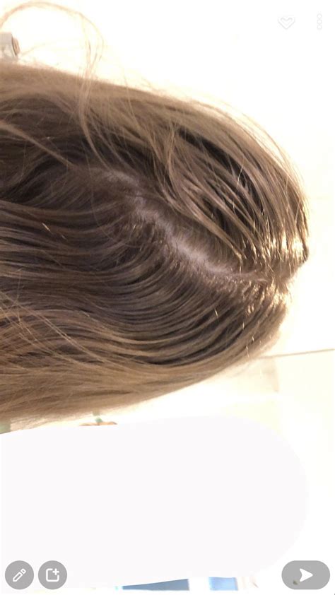 How To Settle Hair Part On The Back Of My Head Haircarescience