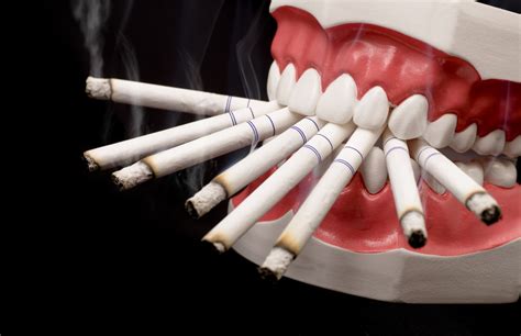 tobacco use and your oral health