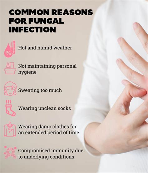 Best 9 Home Remedies For Fungal Infection That Will Give You Relief