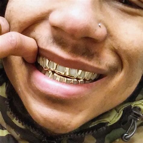 Four types of alloys are defined in en iso 1562 and 8891 respectively, covering a wide range of uses in conservative and restorative dentistry and orthodontics. Style-y0600 6 Cap Open Face Gold Grills | Grillz teeth, Gold teeth grills, Grillz