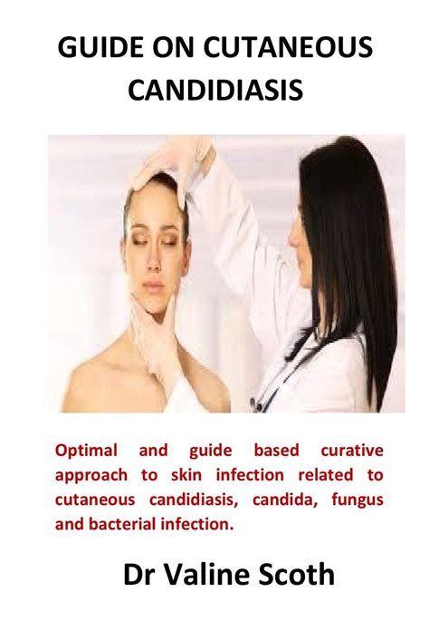 Buy Guide On Cutaneous Candidiasis Optimal And Guide Based Curative