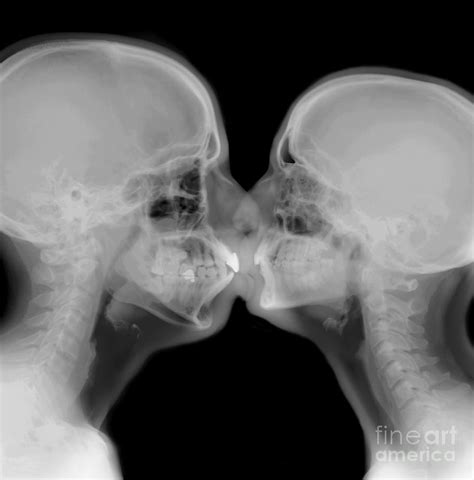 X Ray Of A Couple Kissing Photograph By Guy Viner Fine Art America