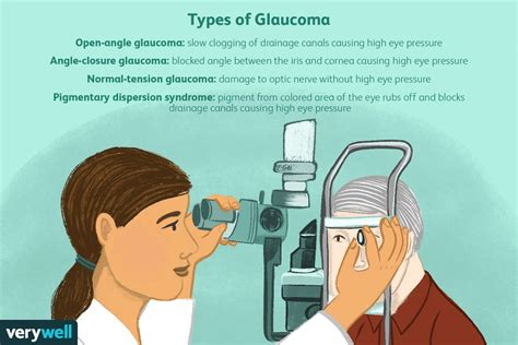 Symptômes Du Glaucome Fmedic