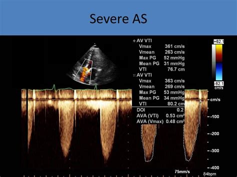 Ultrasound Registry Review Valvular Abnormalities