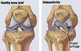 Osteoarthritis Doctor Specialist Pictures