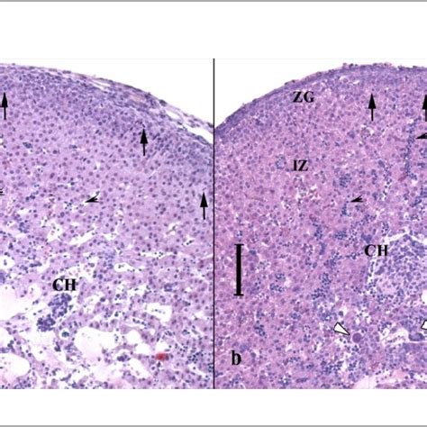 A Zona Glomerulosa Zg With Numerous Dividing Cells → Inner Zone