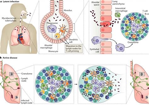 Mycobacterium Tuberculosis Review Microbewiki