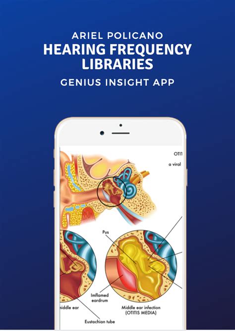 Hearing Frequency Libraries Genius Insight Ariel Policano Insight
