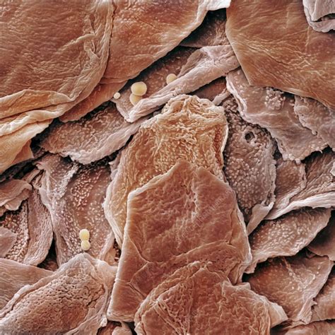 Human Skin Cells Sem Stock Image C Science Photo Library