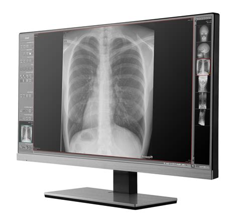 X Ray Png Transparent Images Png All