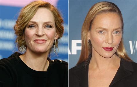Uma Thurman Plastic Surgery For A Different Face
