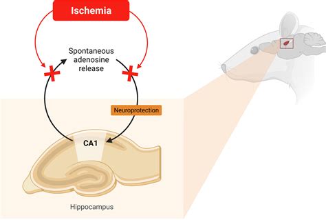 Does The Inability Of Ca1 Area To Respond To Ischemia With Early Rapid