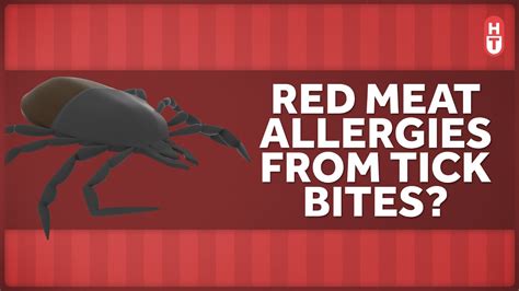 How Can A Tick Bite Make You Allergic To Red Meat Youtube