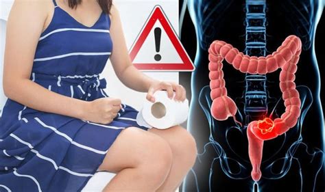 bowel cancer symptoms signs of a tumour in the toilet should poo sink or float uk