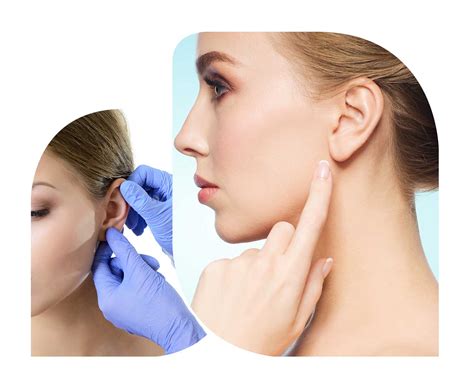 Ear Surgery Otoplasty Cleveland Cosmetic Surgery