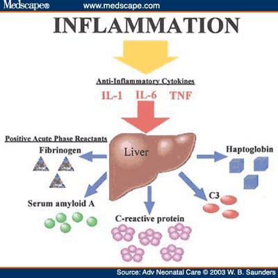 Liver function test interpretation (lfts) | liver enzymes remastered (bilirubin, ggt, alk phos). Reactant, acute phase. Causes, symptoms, treatment ...