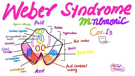 Weber Syndromemnemonic For Usmleplabfcps Medicine Youtube