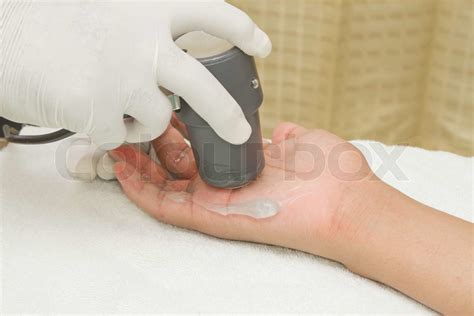 Physiotherapist Is Applying Ultrasound Therapy On The Hand With