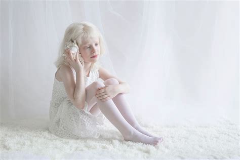 Fotógrafo captura a hipnotizante beleza de pessoas albinas Acredita