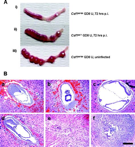 Absence Of Csf 1 Results In Decidual Tissue Destruction And Fetal Loss