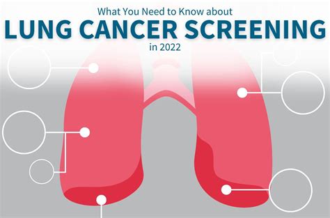 What You Need To Know About Lung Cancer Screening In 2022 Division Of Cardiothoracic Surgery