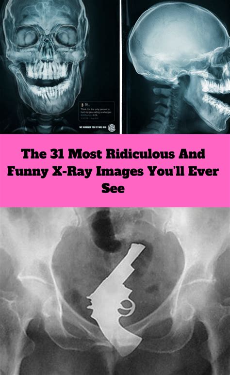 The 31 Most Ridiculous And Funny X Ray Images Youll Ever See In 2020