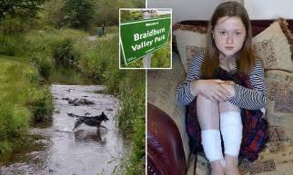 Edinburgh Girl Suffers Chemical Burns After Paddling In Stream On After