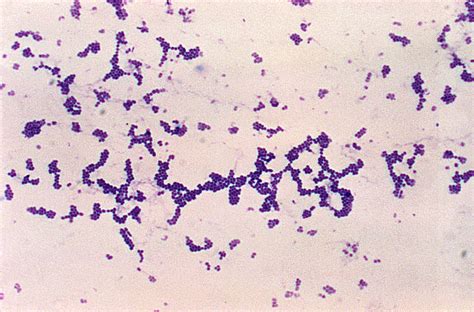Free Picture Photomicrograph Spherical Cocci Gram Positive