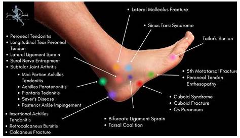 foot pain diagnosis chart