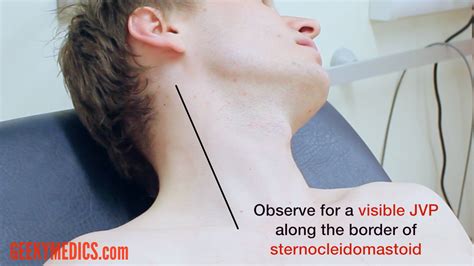 Respiratory Examination Osce Guide Geeky Medics
