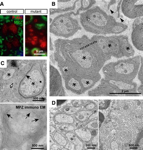 Normally Nonmyelinated C Fiber Axons Are Spirally Enwrapped By Remak