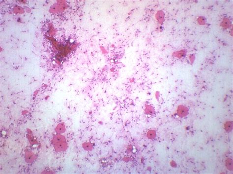 Eisco Prepared Microscope Slide Histology Human Sperm Smear