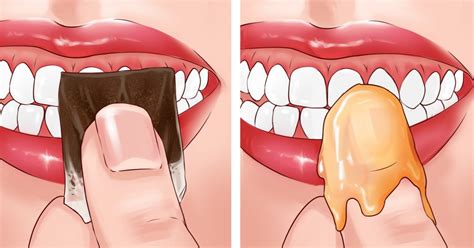 When your ovaries stop producing estrogen, youre in a higher risk category for developing osteoporosis. How To Treat Bleeding Gums Naturally at Home:10 Expert Tips