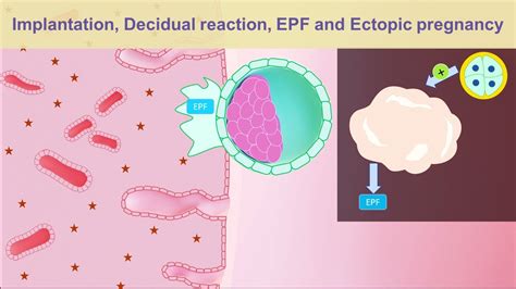 Implantation Decidual Reaction Epf And Ectopic Pregnancy Youtube