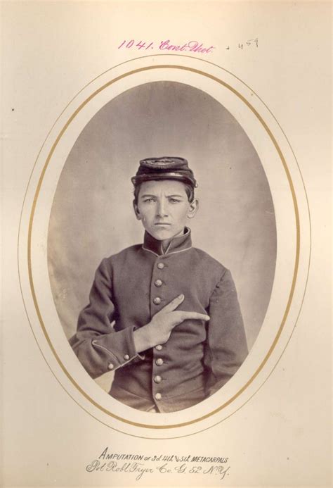 Civil War Portraits Of The Broken Bodies Sent Home