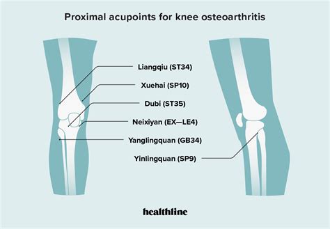 Acupuncture For Knee Osteoarthritis Procedure And Effectiveness