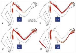 An Approach To The Painful Upper Limb Mogere Continuing Medical