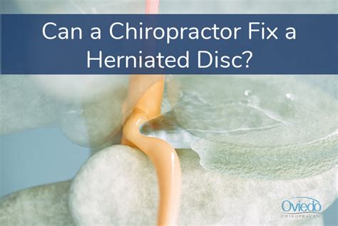 Can A Chiropractor Fix A Herniated Disc Oviedo Chiropractic