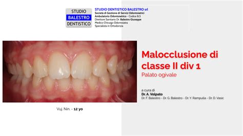 Studio Dentistico Balestro Malocclusione Di II Classe Div 1