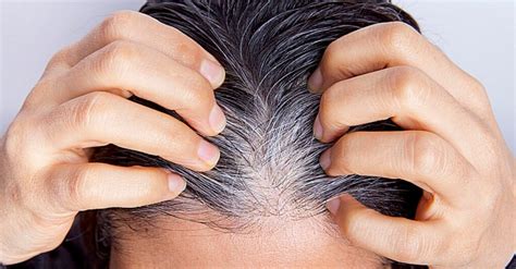 Cheveux blancs : après un épisode de stress, ils peuvent retrouver