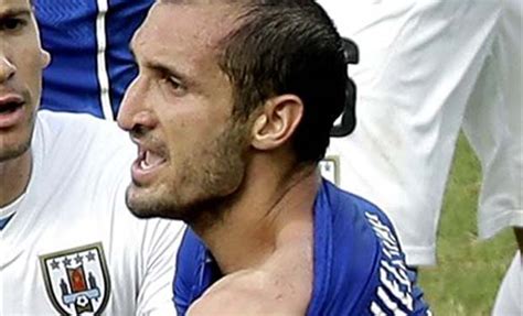 FIFA World Cup 2014: Luis Suarez gets chunk of Chiellini ...