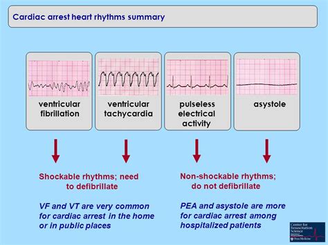 early cpr matters what about early defibrillation first important to understand different