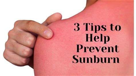 3 Tips To Help Prevent Sunburn Youtube