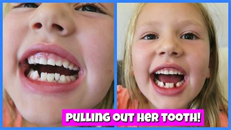 7 tips to painlessly pull a loose tooth • tip 1: PULLING OUT HER LOOSE TOOTH! - YouTube