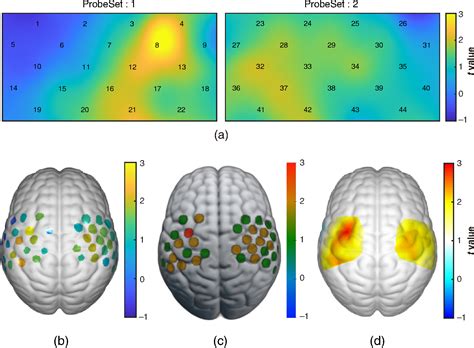 Nirs Kit A Matlab Toolbox For Both Resting State And Task Fnirs Data