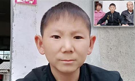 Chinese Man 34 Is Trapped In A Six Year Olds Body Due To Brain