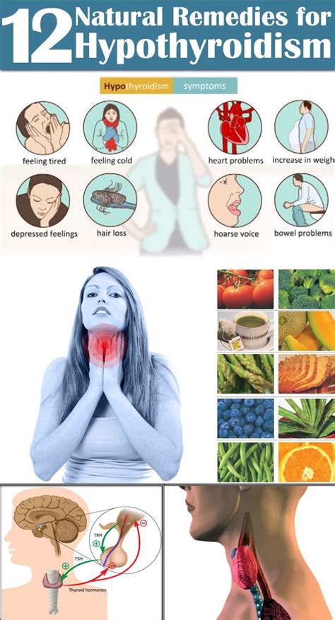 12 Simple Remedies For Hypothyroidism Health And Wellbeing