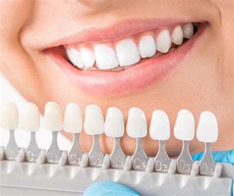 How Do We Whiten Teeth Codsall Dental Practice