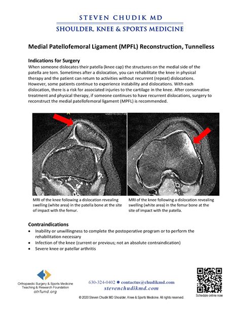 Medial Patellofemoral Ligament Mpfl Tunnelless Reconstruction